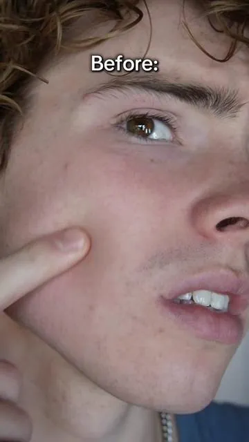 Simple Skincare with @BASED 