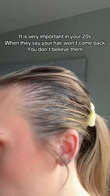 Don't believe them. The science is finally here for Hairgrowth. Results may vary. @medicube global #hairlosswomen #pdrnshampoo #thinninghair #scalphealth #pcosproblems 