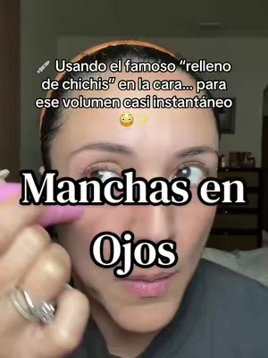 Ojeras, ojos hundidos y manchados, piel deshidratada, ojos manchados , falta de volumen en la cara, pdrn, volumizer 5% #ojeras #ojerasoscuras #dealsforyoudays #medicube #ojostristes disclaimer: precio promociones y resultados pueden variar 