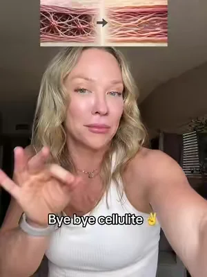 I truly thought I was stuck with my cellulite… but I have seen such an improvement since consistently using this fascia massager  ##fasciarelease##cellulitereduction##cellulitemassage 
