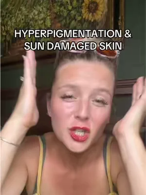 Replying to @✨Kellie Bowden✨ can we have a little chat about hyperpigmentation and dark spots?  . . . . . this is my experience, this is not medical advice and results may vary 
