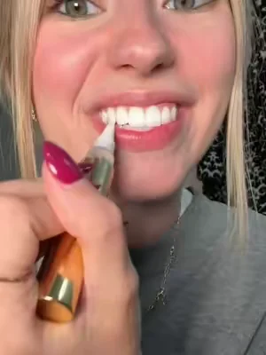 why didn’t I use this sooner 🙄#teethwhitening #yellowteeth #whiteningteeth #snowteethwhitening #snowteethwhitening @Snow Teeth Whitening 