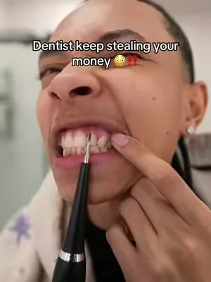 Replying to @brokethescore0 flossing is not enough! #DealsForYouDays #dentalcare #plaqueremover #oralhealth 
