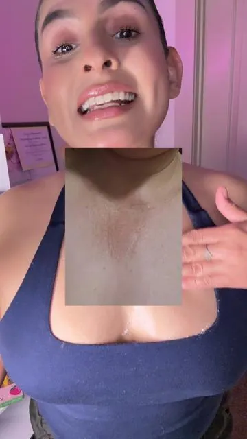 #manchasenlapiel #kbeauty 