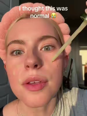 bye bye pores #peelshot #drmelaxinpeelshot #drmelaxin #bigpores 