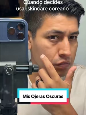 cómo reducir ojeras oscuras después de los 50, tratamiento para bolsas y ojeras en piel madura, skincare para mujeres mayores de 50 años, contorno de ojos antiedad, parches para ojos con ácido kójico, cómo iluminar el contorno de ojos, cuidado de la piel madura con ojeras, rutina de skincare coreano para +50, ojos cansados y piel madura, parches de hidrogel para ojeras profundas #MayoresDe50 #OjerasOscuras #PielMadura #ContornoDeOjos #SkincareCoreano50Plus 