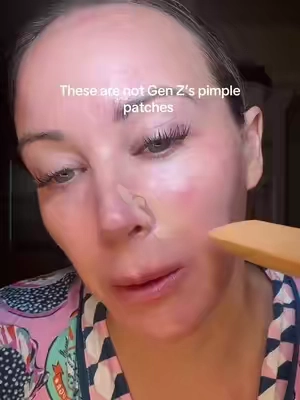 Brand new ultra thin basically invisible pimple patches you can wear under makeup #drmelaxin 